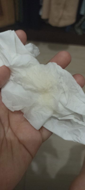 Bun ada yang pernah ngalamin keputihan warna kuning kek gini GK?
Aku usia kehamilan 26 weeks Bun.