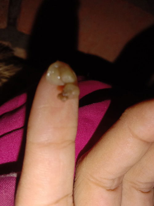 Bun kenapa ya saat HB  sama suami keluar darah cuman dikit udah tu keluar keputihan kayak ampas tahu