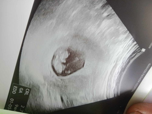 อยากทราบว่าแม่ๆคิดว่ากี่เดือนค่ะ