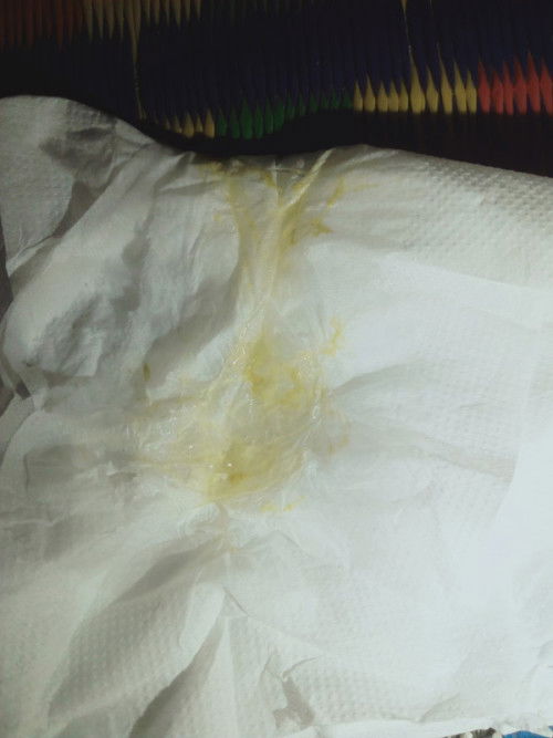 Keputihan atau mucusplug?