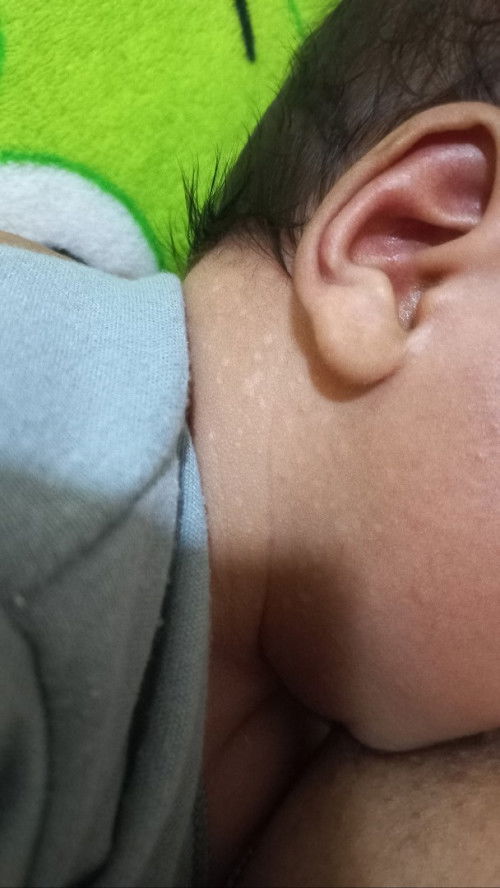 Bintik putih di leher