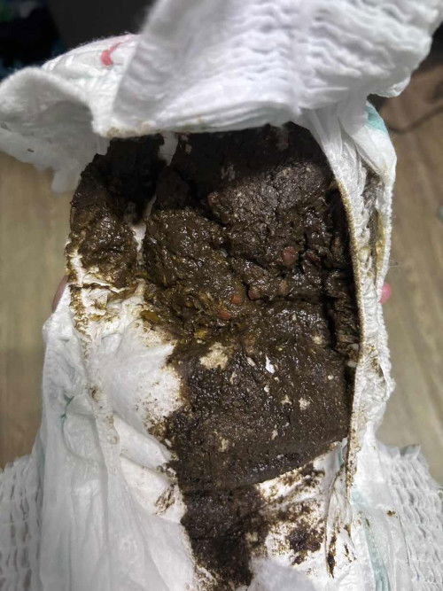 berak baby setahun sebulan