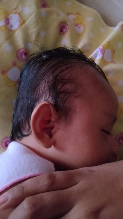 Brtanya seputar kepala bayi