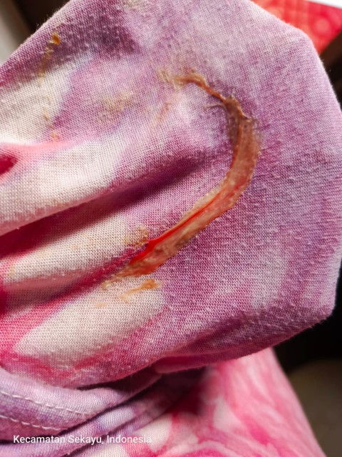 36 minggu 2 hari saya keluar lendir keputihan coklat muda campur darah kayak di foto bun