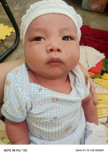 Hi Can I Ask Po Pwede Nyo Po Ba Sakin Sabihin If May Down Syndrome Baby Ko Base Sa Face Nya Thanks.