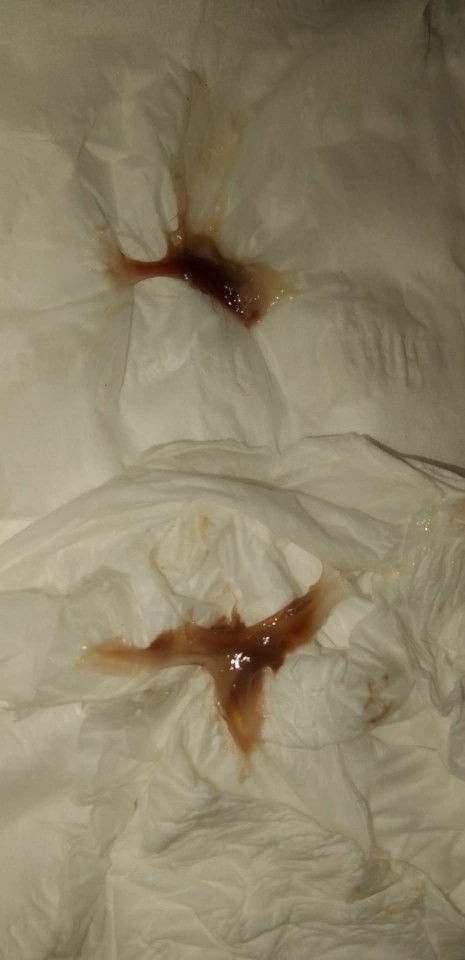 แบบนี้ปกติไหมคะแม่ๆ