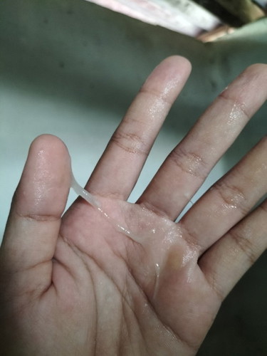 มูกใสเป็นแบบนี้มั้ยคะแม่ๆ 36+5