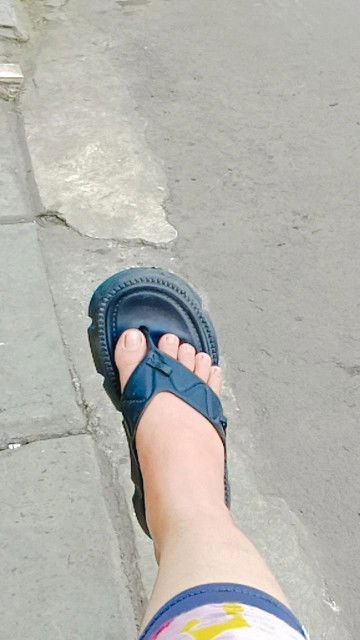 Kaki bengkak bengkak