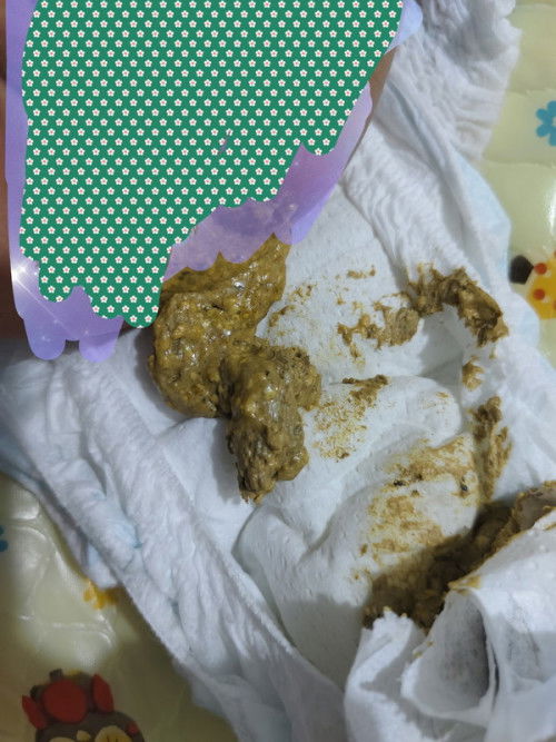 อึน้องสีปกติไหมคะ