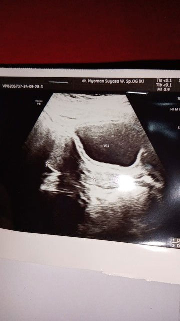 Bingung karna tidak di jaelaskan