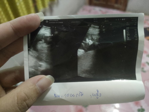 ช่วยยืนยันหน่อยค่ะว่าแม่ไม่ได้ฝันไป😆