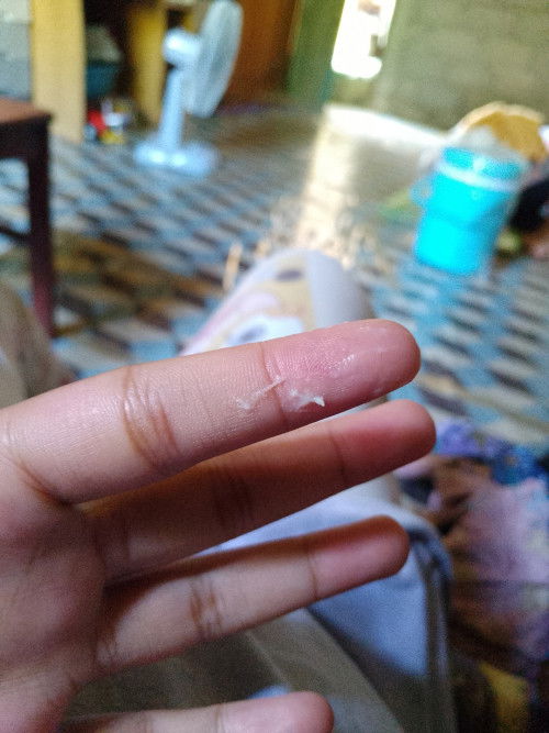 ตั้งครรภ์ 35 สัปดาห์