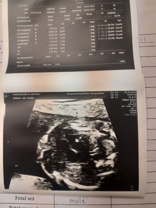 ตรวจดาวซินโดม