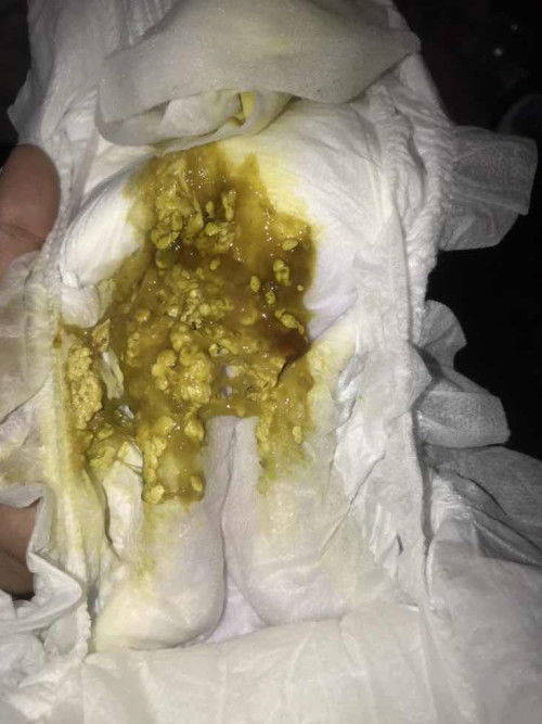 kenapa najis baby macam ni ?