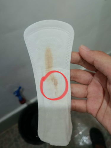 Normal lang ba ang pink discharge sa 11 week na pagbubuntis?