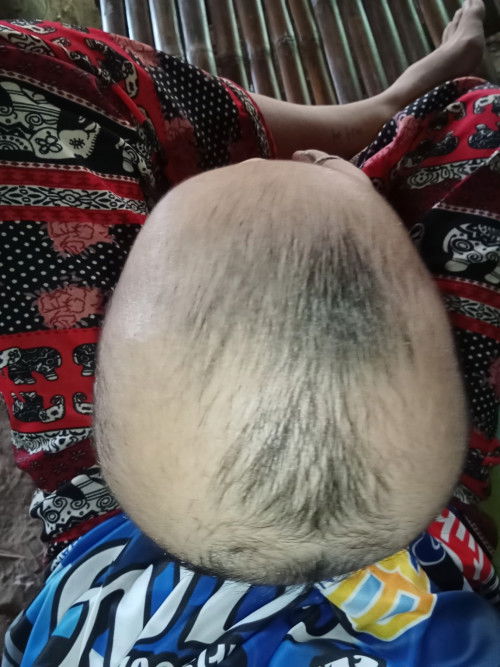 ลูกหัวเบี้ยว