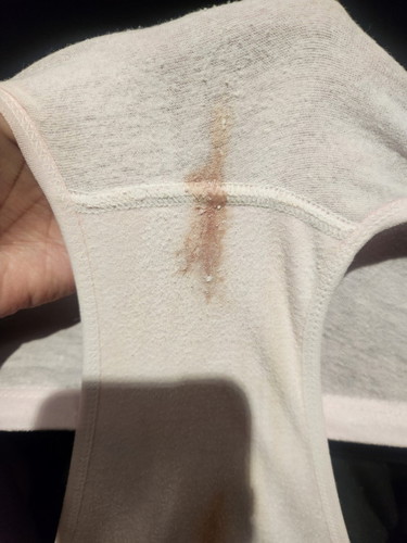 Hi saya sekarang pregnant 8 weeks. Pagi ni saya nampak ni kat panties. Any idea apa ni?