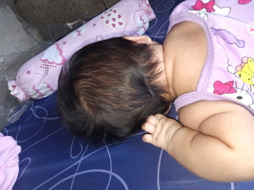 Flat head si baby