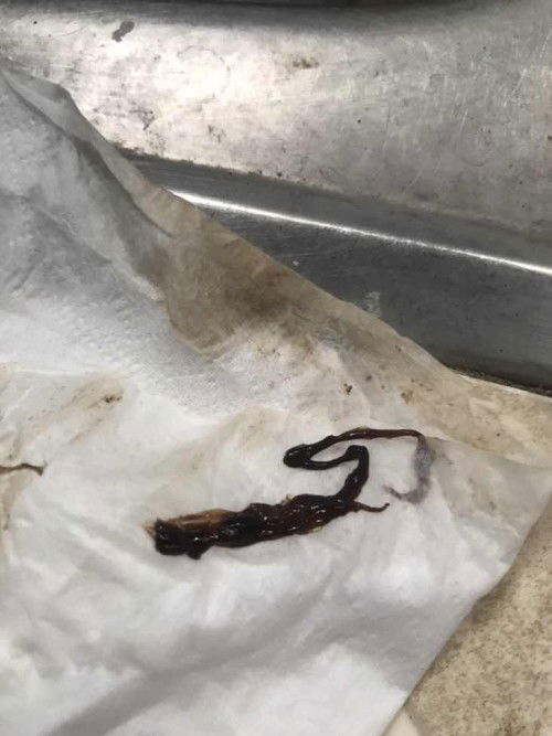 Brown na discharge parang clot o tissue