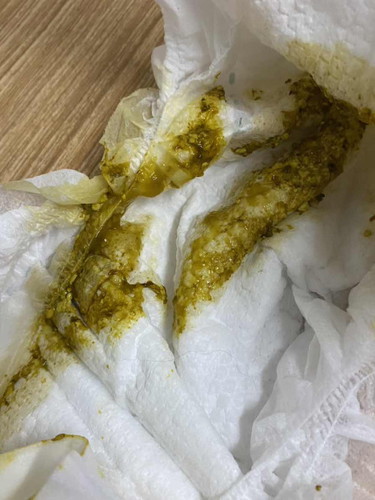 Diarrhea 5 months old