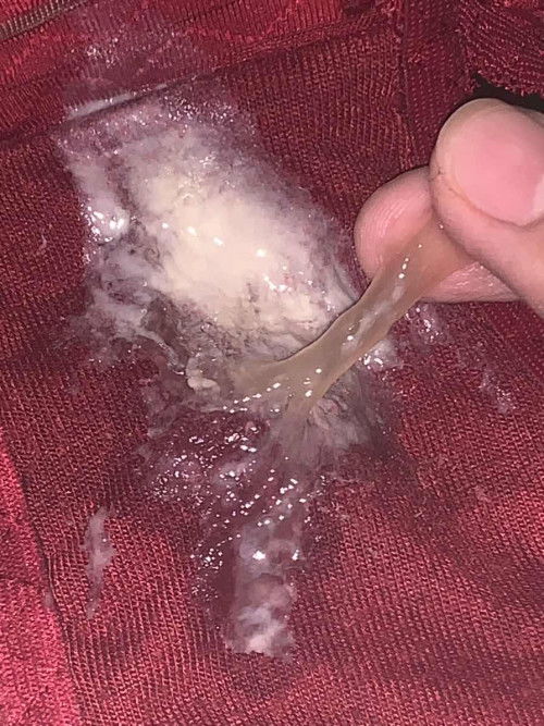 flek atau cairan kental