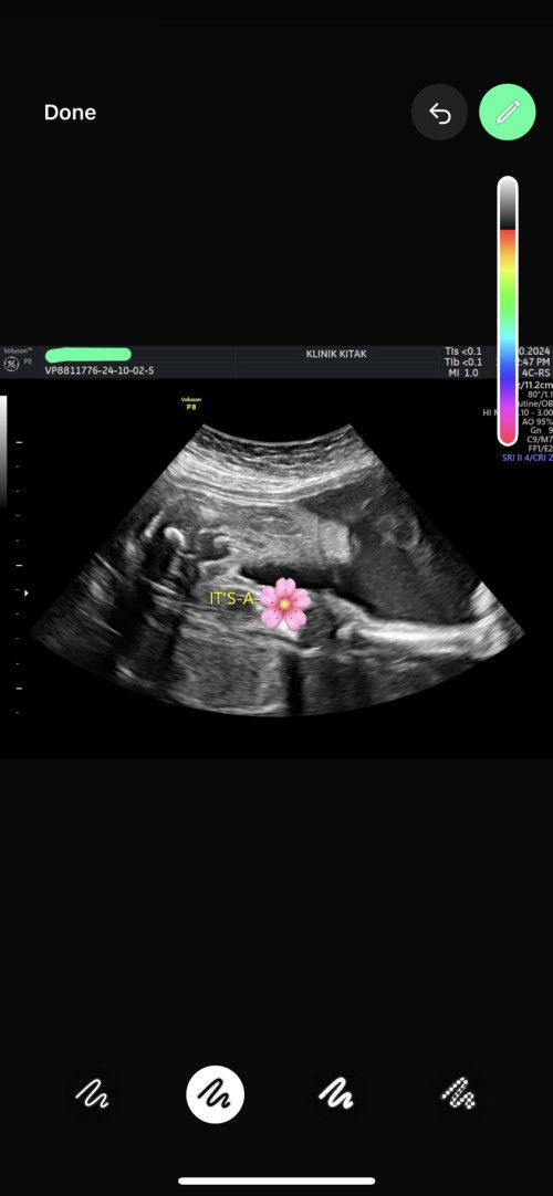 Boleh tlg tak.. ini boy or girl