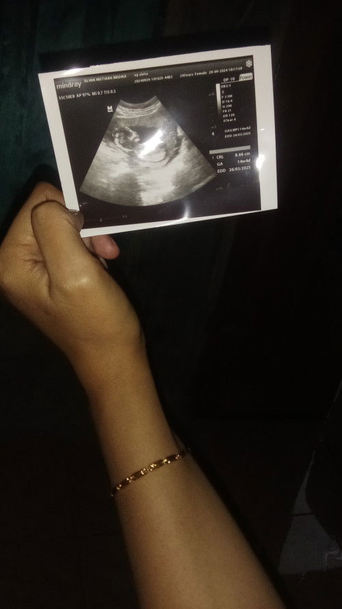baru Minggu kemarin USG usia kehamilan baru 3 bulan lebih .belom keliatan JK nya ,masih di umpetiDde