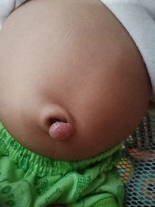 Pusar bayi belum kering