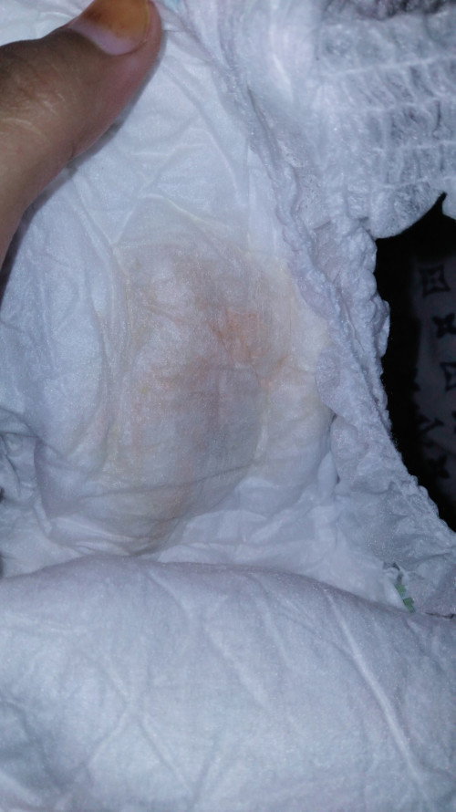 Pipis bayi berwarna orange