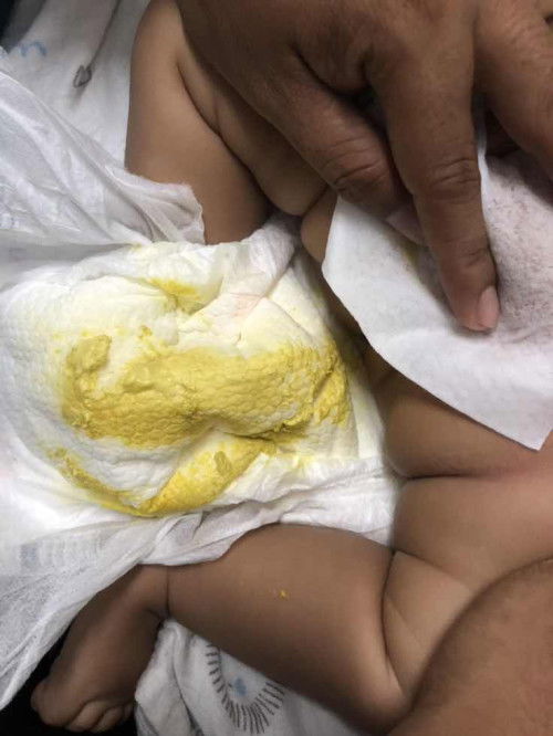 Bayi minum susu dutch baby