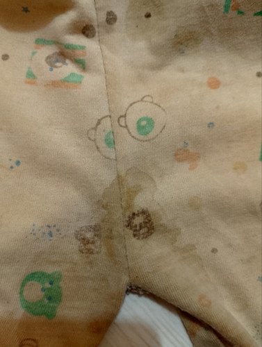 Mau tanya,ini darah gak sih?
Soalnya tadi baru liat di celana anak aku yang berumur 1 tahun