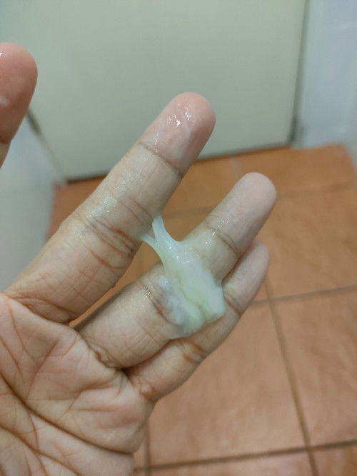 แบบนี้มูกหรือตกขาวคะ