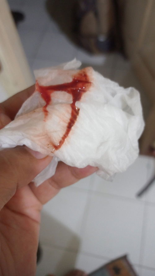 Apakah tanda keguguran?