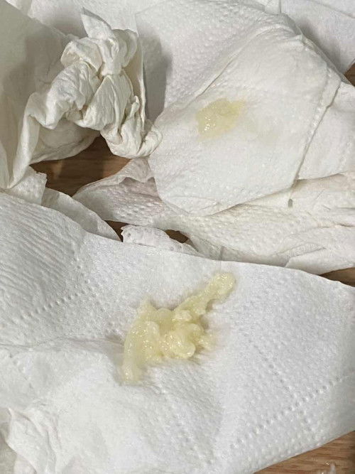 มีตกขาวแบบนี้หมายถึงยังไงหรอคะ ตอนนี้ท้องได้37+6 ปรึกษาหน่อยค่ะแม่ๆ