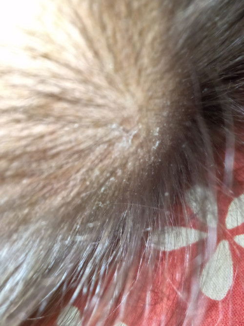 Kulit kering atau apa