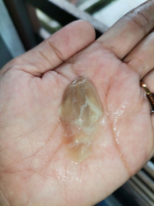 38w n brownish spotting