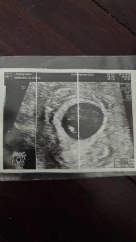 6วีค เจอน้องแล้ว