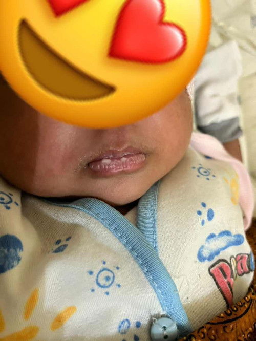 Mulut bayi bercak putih