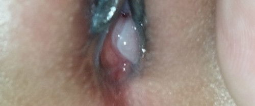 KEPUTIHAN DIBAYI 3 BULAN