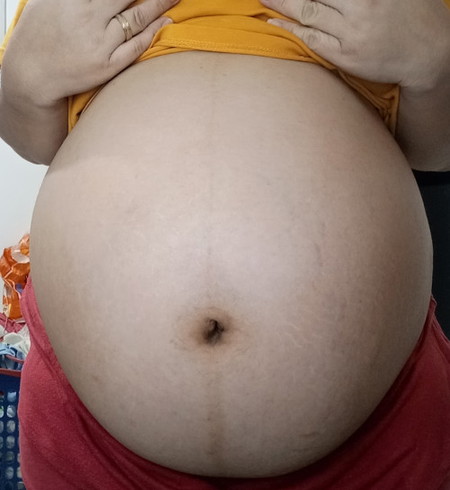 32 Weeks Pregnant