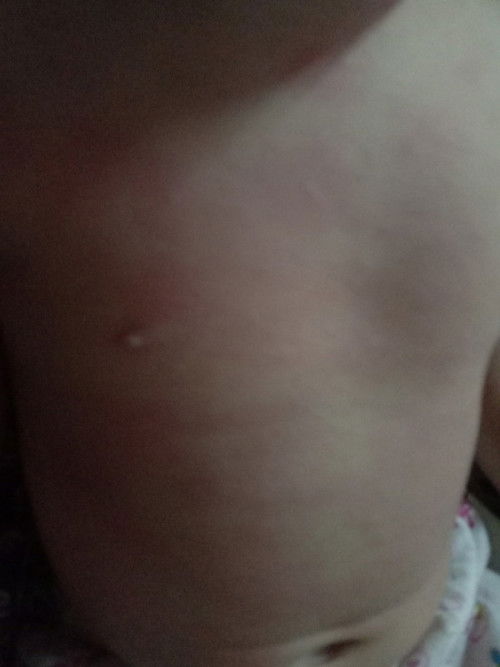 เกิดจากอะไรค่ะ