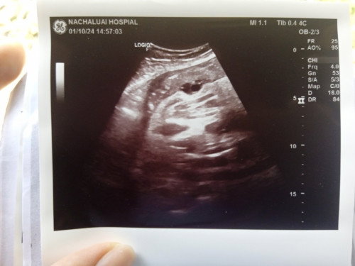 ผู้หญิงหรือผู้ชายค่ะ