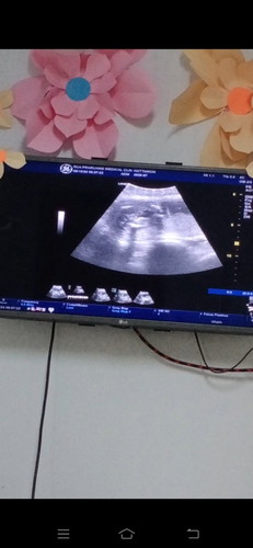 ชายหรือหญิงคะช่วยดูหน่อยค่ะแม่ๆ