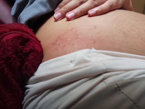 Rushes on my belly