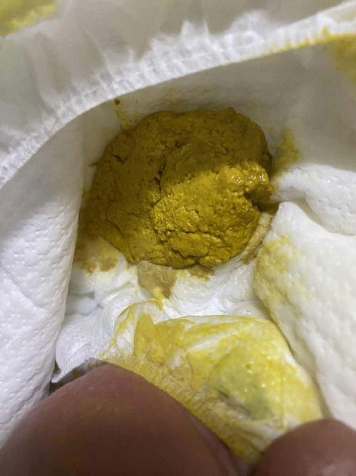 อึน้องแบบนี้ปกติไหมคะ น้องอายุ 11 วันค่ะ ทานนมผงนมแม่ผสมกันค่ะ