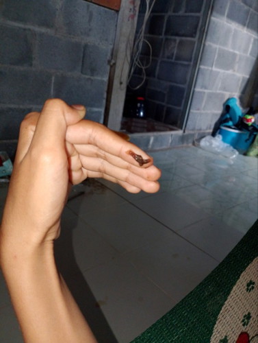 11วีค6วันไม่มีอาการปวดท้อง