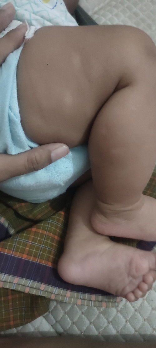 Kulit bayi tidak rata