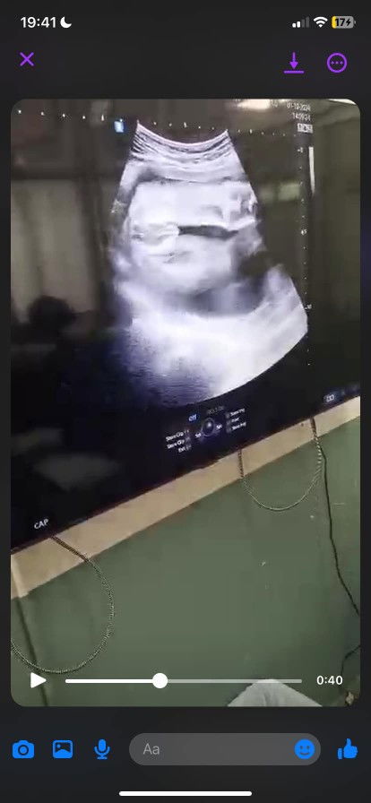 อยากรู้ว่าน้องเพศหญิงหรือเพศชาย