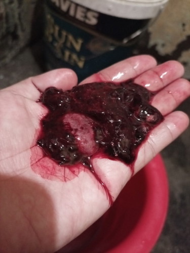 Posible po bang nalaglagan aq