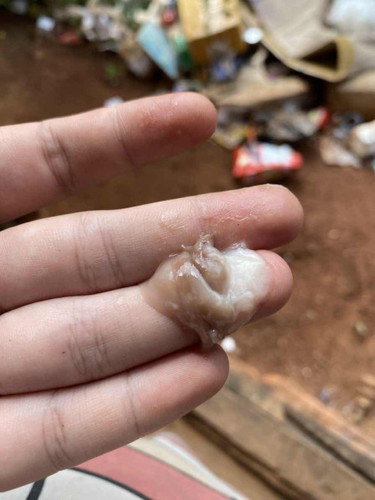 39+6วีด ไหลออกมาเป็นสีน้ำตาลอ่อนๆคล้ายๆเลือด